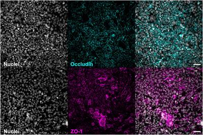 PerfuPul—A Versatile Perfusable Platform to Assess Permeability and Barrier Function of Air Exposed Pulmonary Epithelia